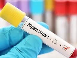बंगाल में ‘निपाह वायरस’ ने दी दस्तक, दो नर्सें की हालत अब भी गंभीर